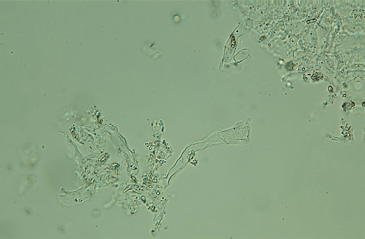 Vuilleminia sp. con cistidi giganti (Vuilleminia comedens)